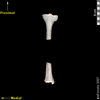 lucy dorsal posterior view of tibia