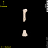 lucy humerus dorsal posterior view