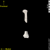 lucy humerus ventral anterior view