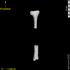 lucy ventral anterior view of tibia